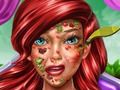 Juego Princesa Sirena: Doctora de la piel  en línea