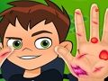 Juego Doctor de la mano Ben10  en línea