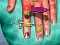 Juego Médico de la piel de la mano  en línea