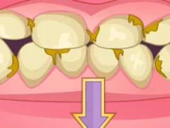 Juego Bad Teeth Makeover en línea