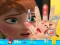 Juego Anna hand doctor en línea