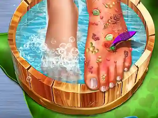 Juego Feet Skin Doctor en línea