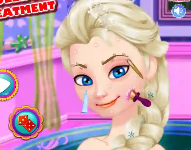 Juego Ice Queen Acne Treatment en línea