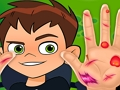 Juego Doctor de la mano Ben10  en línea