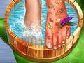 Juego Médico de la piel de los pies  en línea