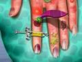 Juego Médico de la piel de la mano  en línea