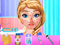 Juego Tratamiento de alergias Anna Spring  en línea